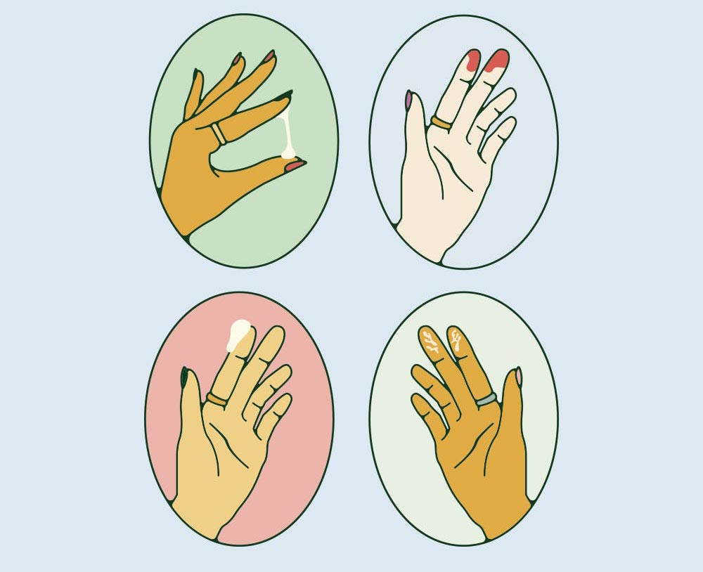 vagina_noznica_izcedek